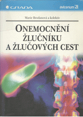 Onemocnění žlučníku a žlučových cest CZ