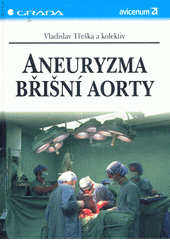 Aneuryzma břišní aorty CZ