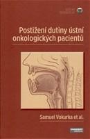 Postiženídutiny ústní u onkologických pacientů CZ
