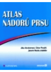 Atlas nádorů prsu CZ