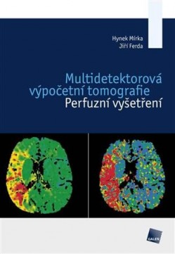 Multidetektorová výpočetní tomografie CZ