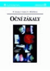 Oční zákaly CZ