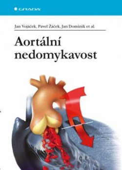 Aortální nedomykavost CZ